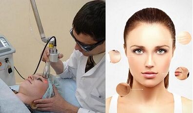 Bawo ni isọdọtun awọ laser ṣe