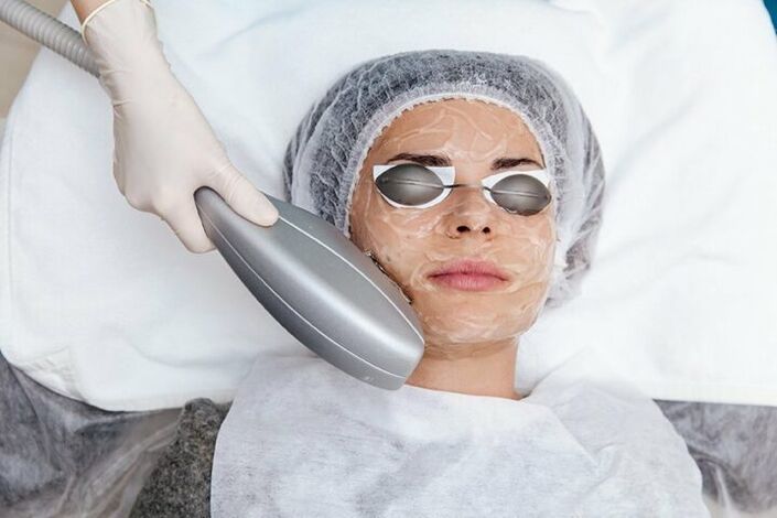 Anti-ti ogbo oju photorejuvenation itọju